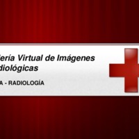 Galería Virtual de Imágenes Radiológicas -Tórax y Parrilla Costal.pdf